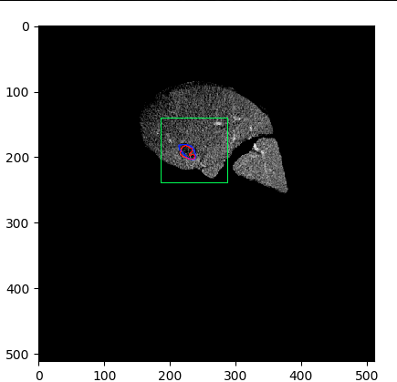 Figure 17