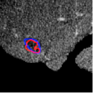 Figure 18