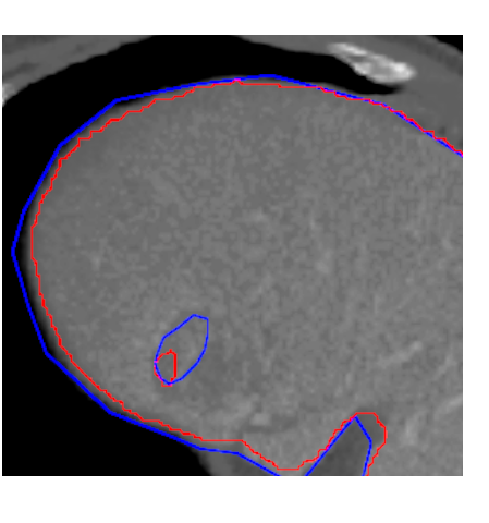 Figure 20