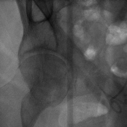 Figure 15