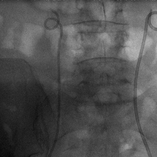 Figure 17