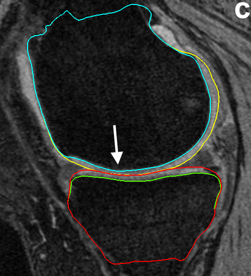 Figure 14
