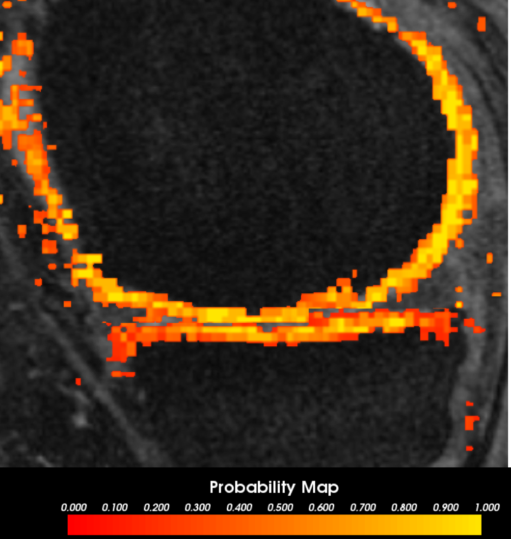 Figure 15