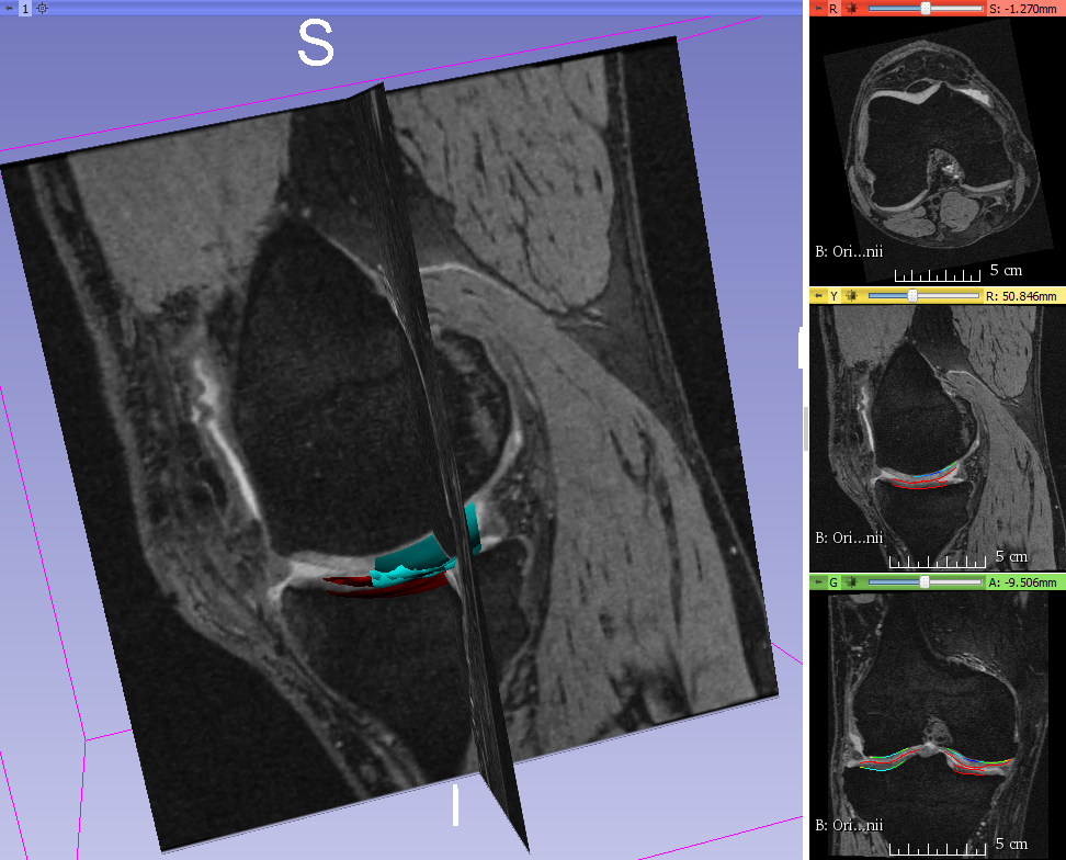 Figure 16