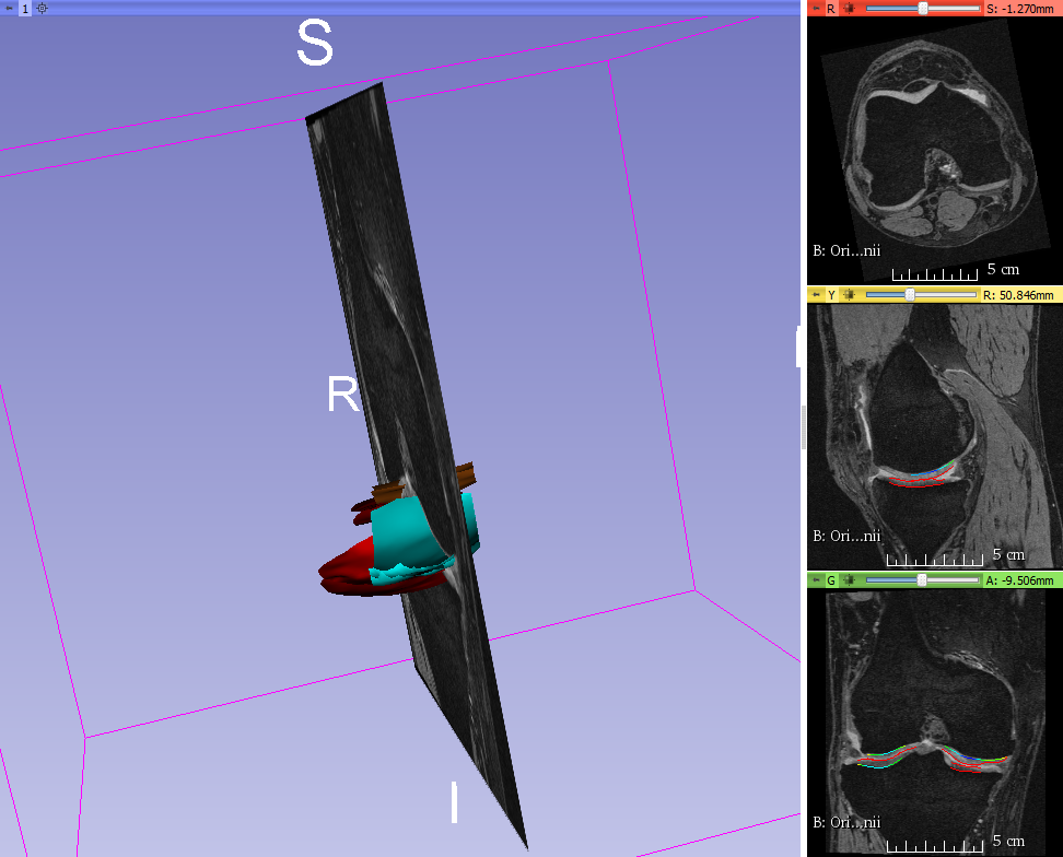 Figure 17