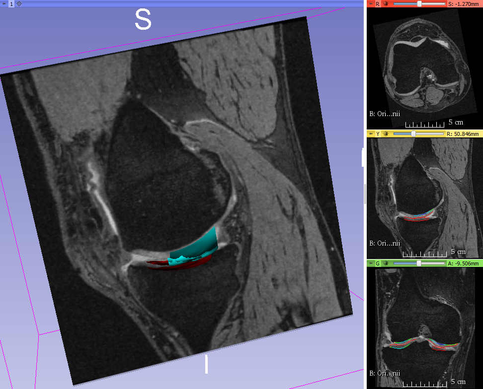 Figure 18