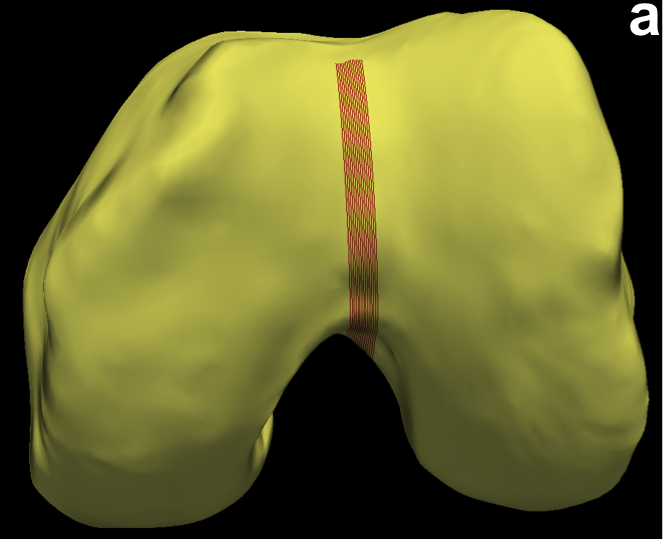 Figure 22