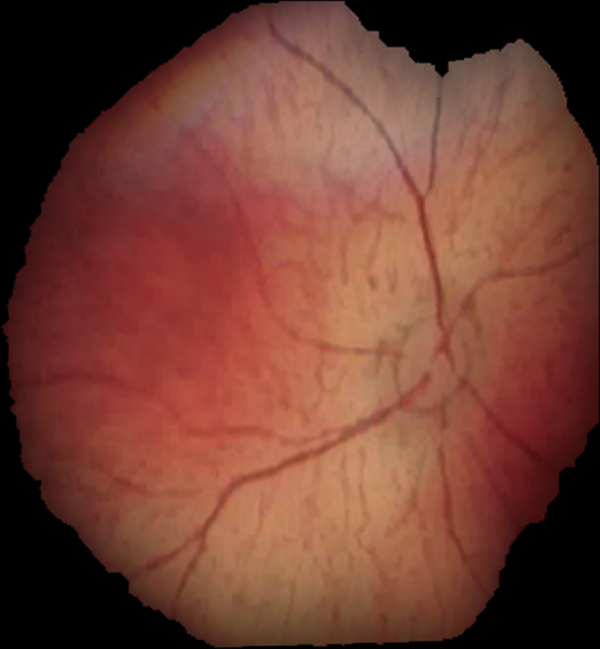 Figure 25