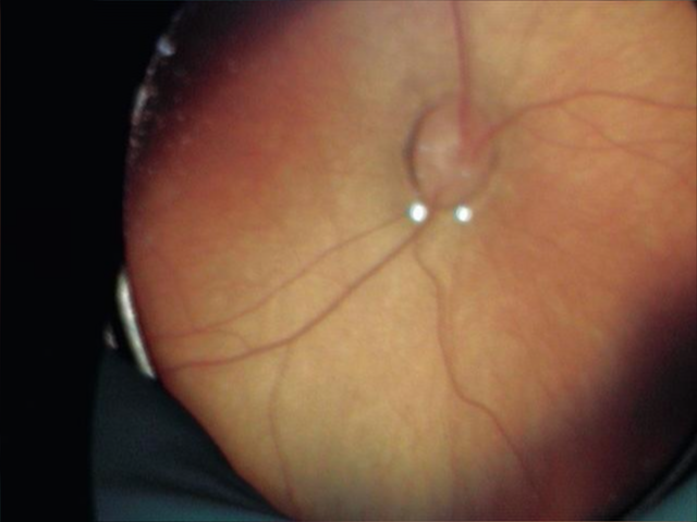 Figure 29