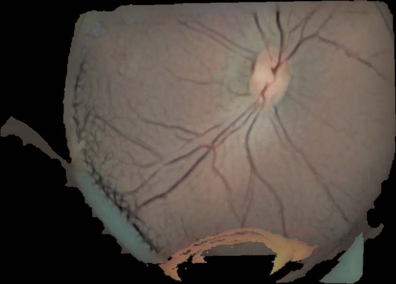 Figure 33