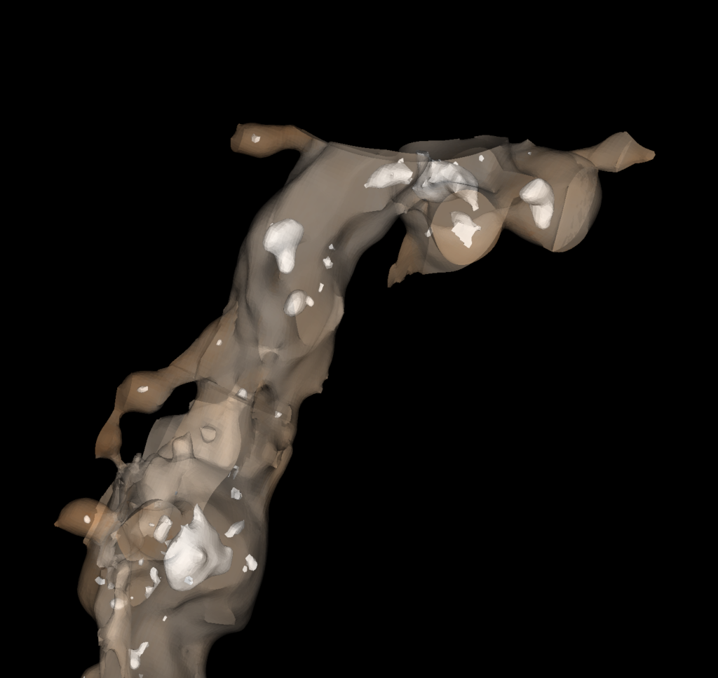 Figure 14