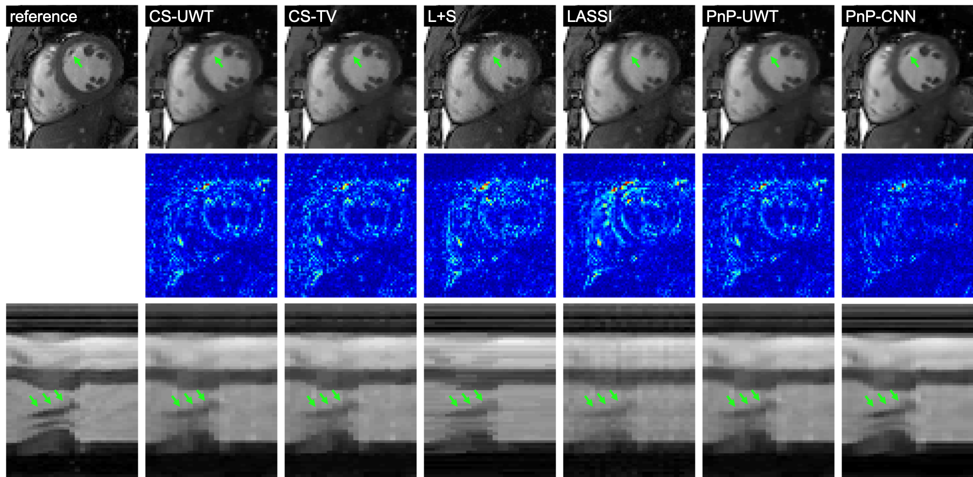 Figure 11