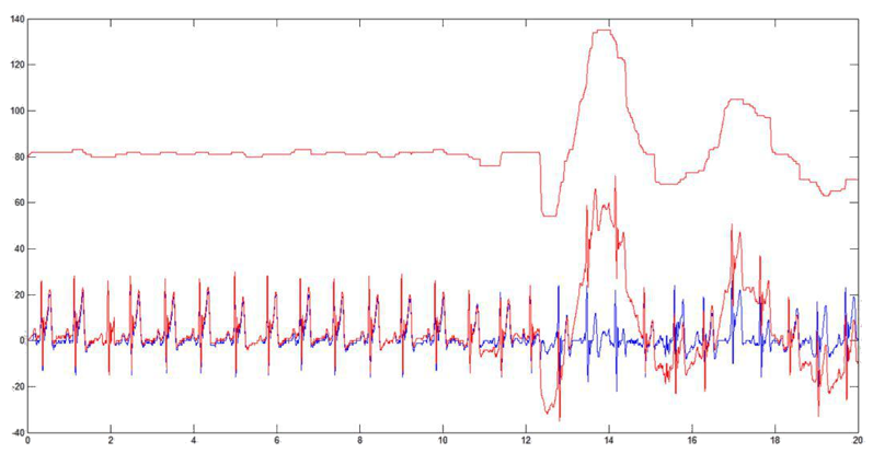 Figure 11
