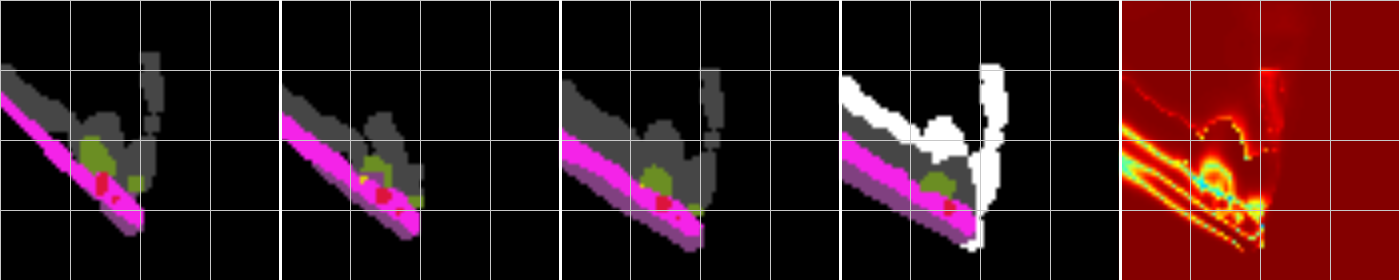 Figure 33
