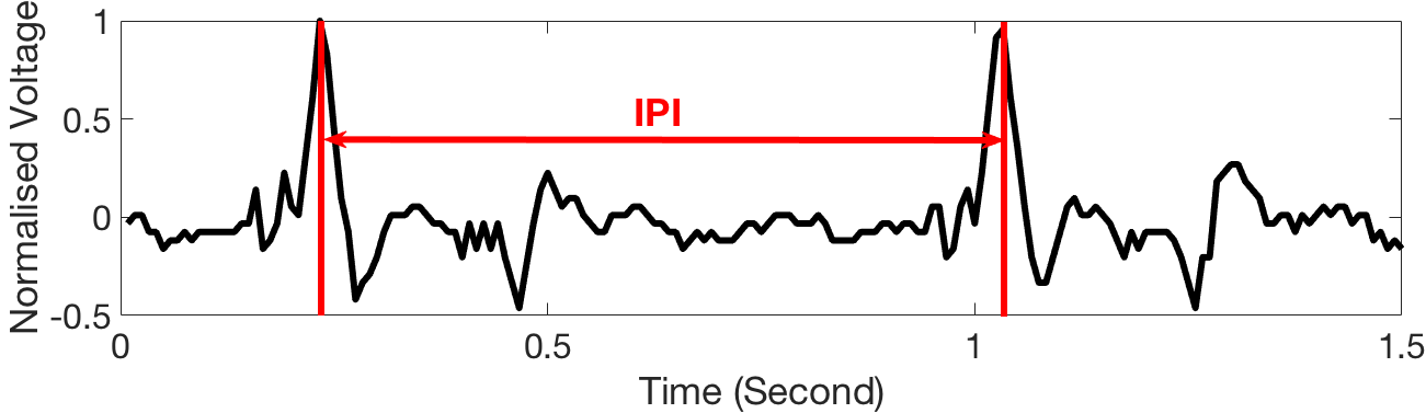 Figure 18