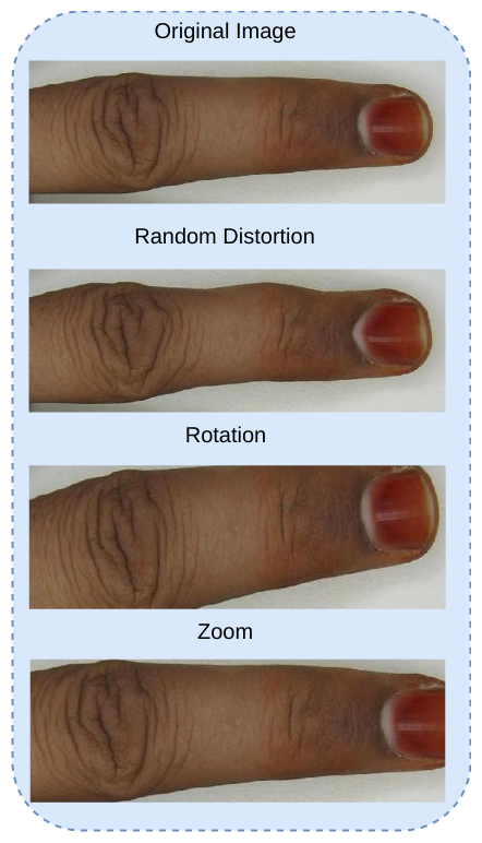 Figure 13