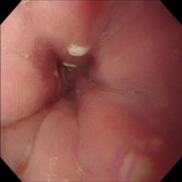 Figure 17