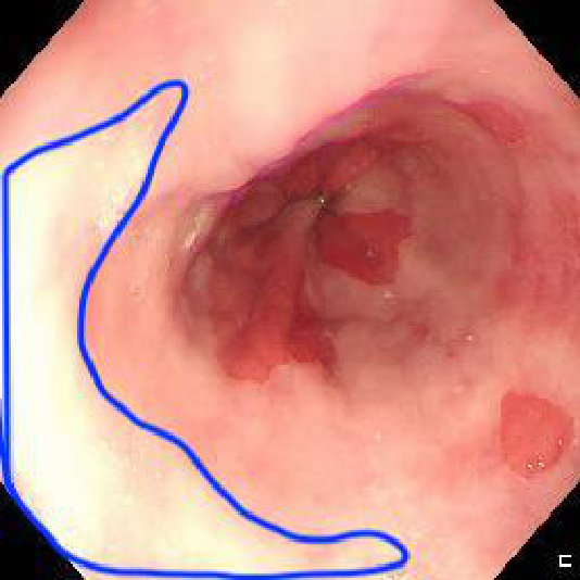 Figure 21