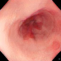 Figure 26