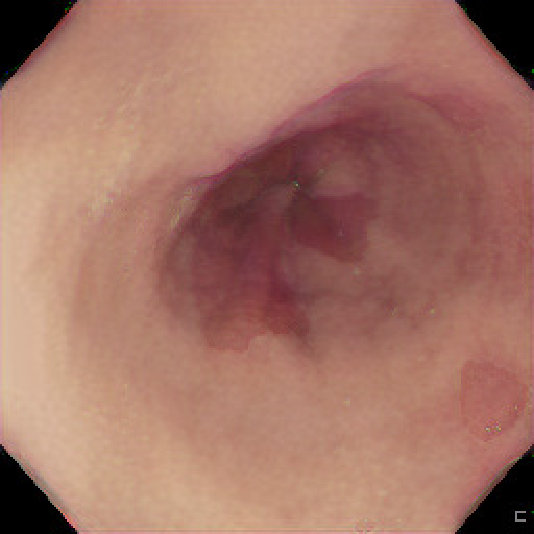 Figure 28