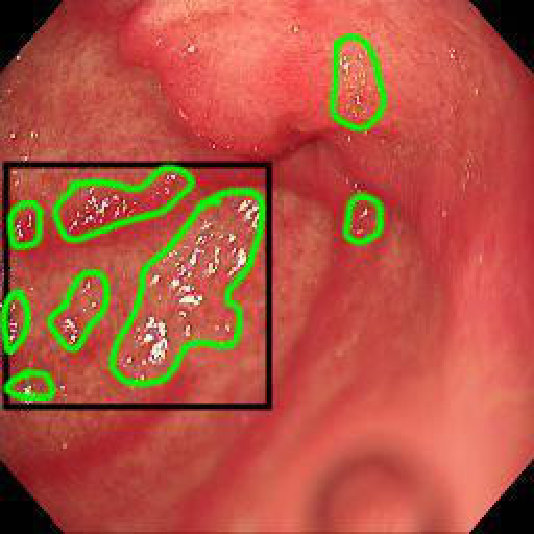 Figure 30