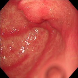 Figure 31