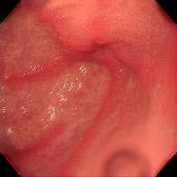 Figure 37
