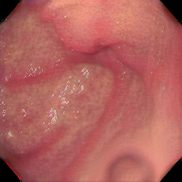Figure 38