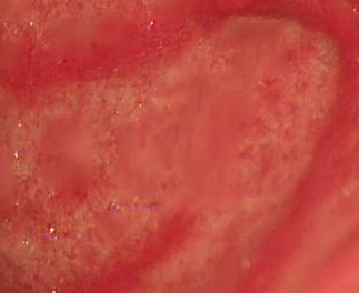 Figure 40