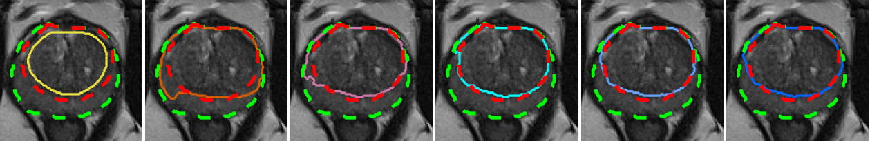 Figure 13