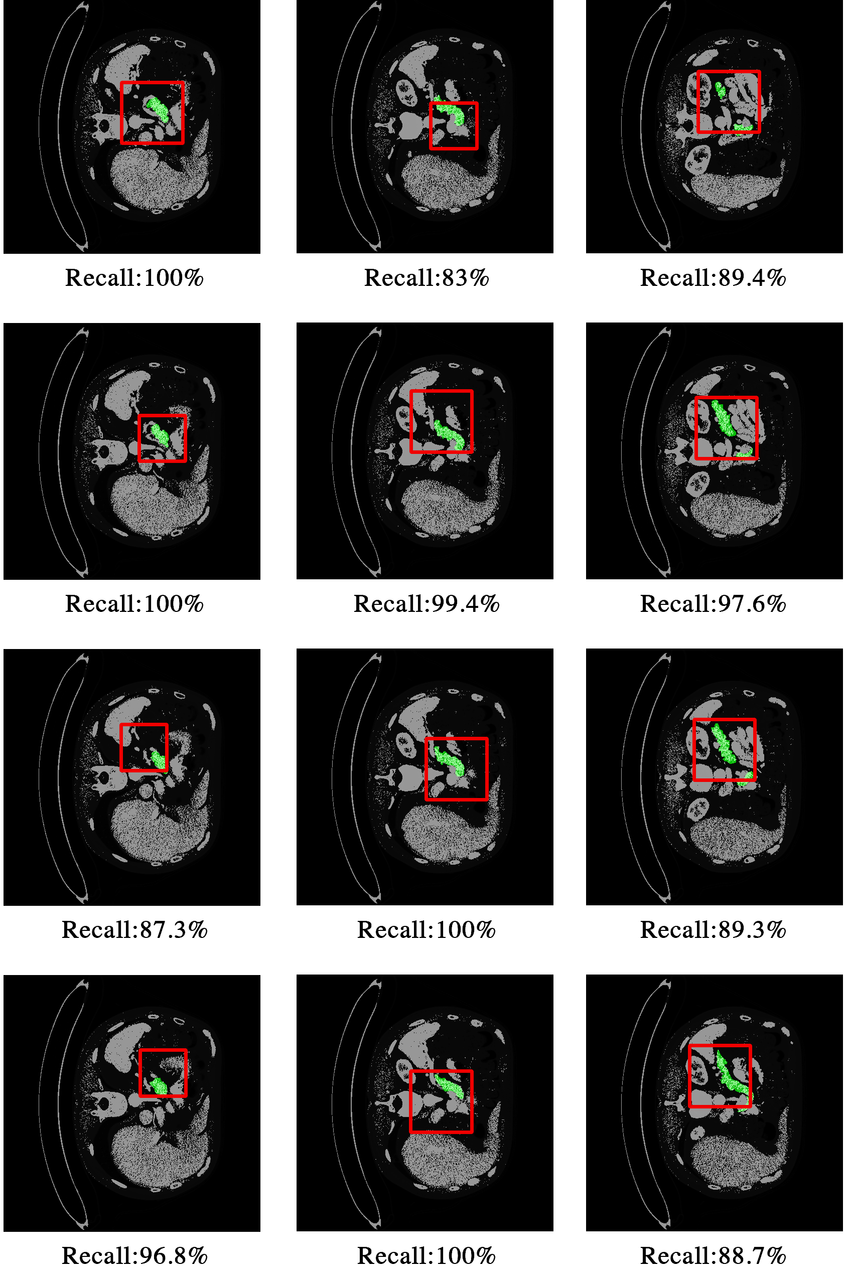 Figure 12
