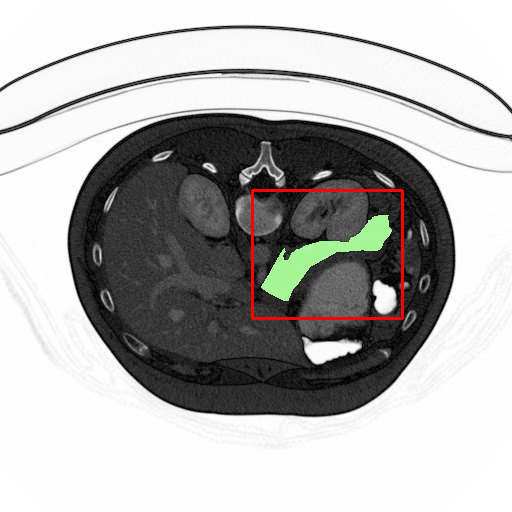 Figure 14