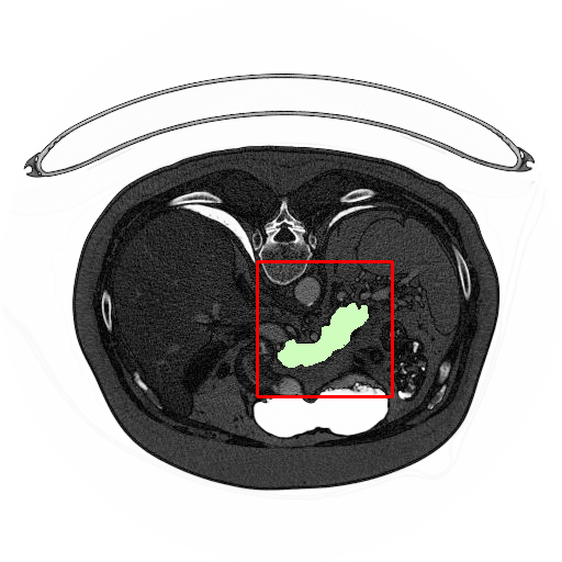 Figure 18