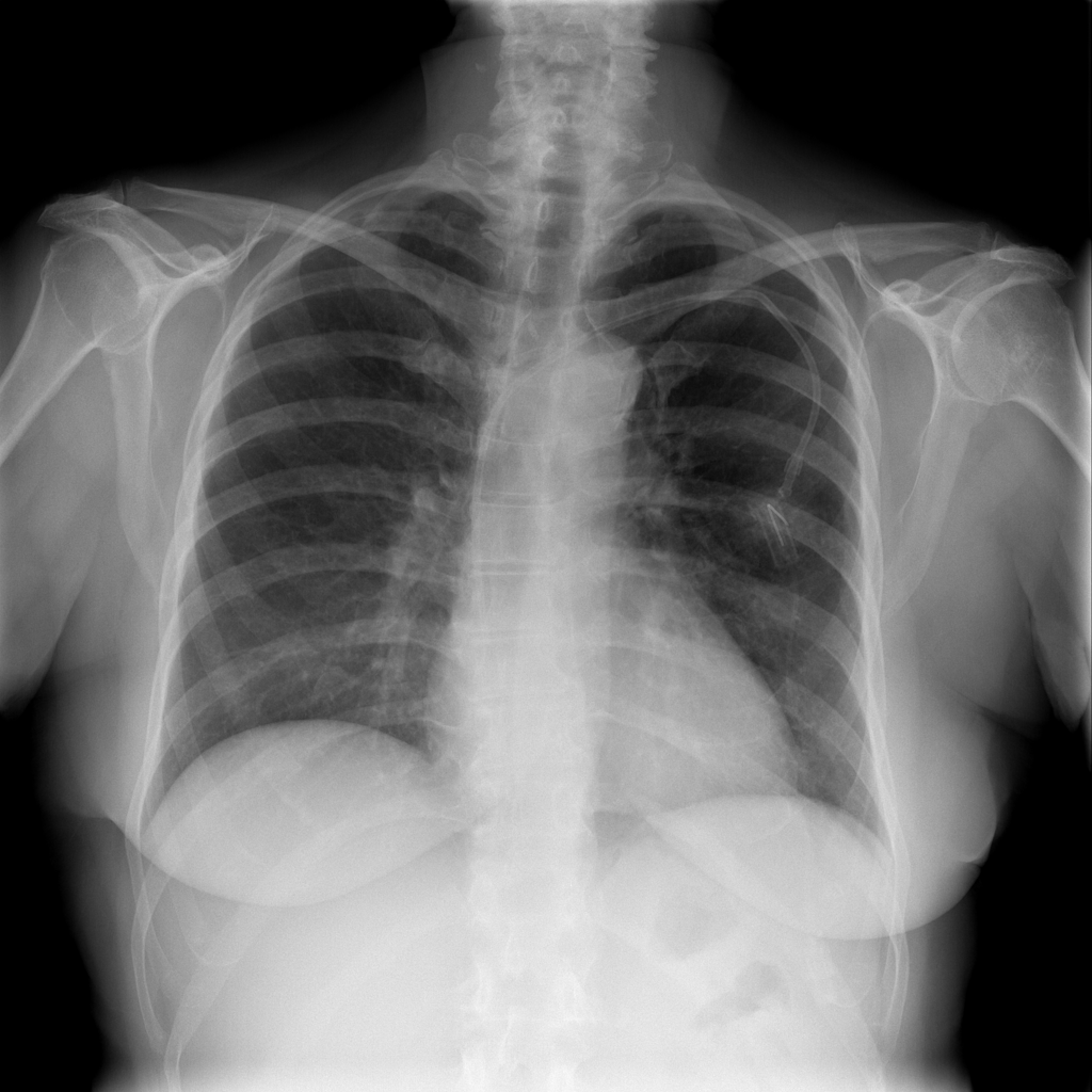 Figure 11
