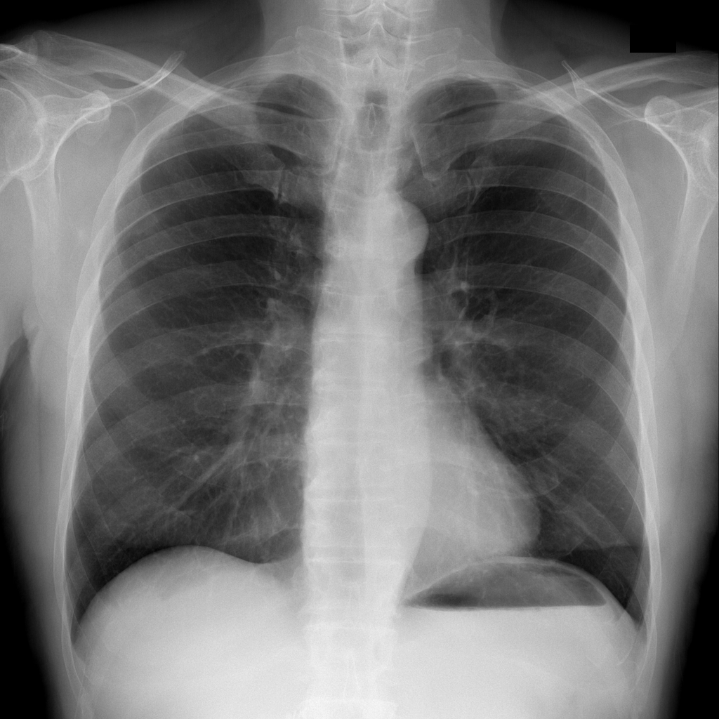 Figure 12