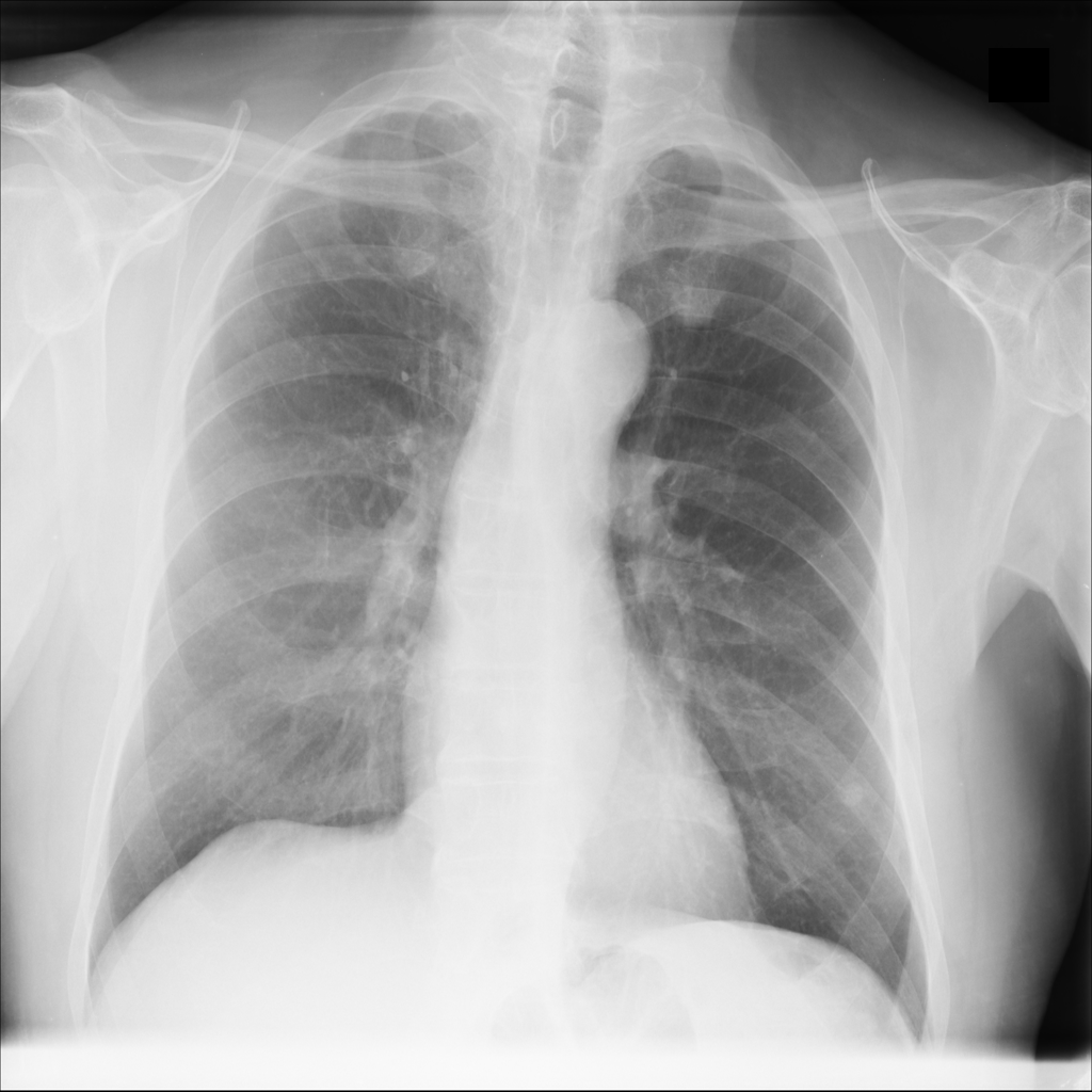Figure 14