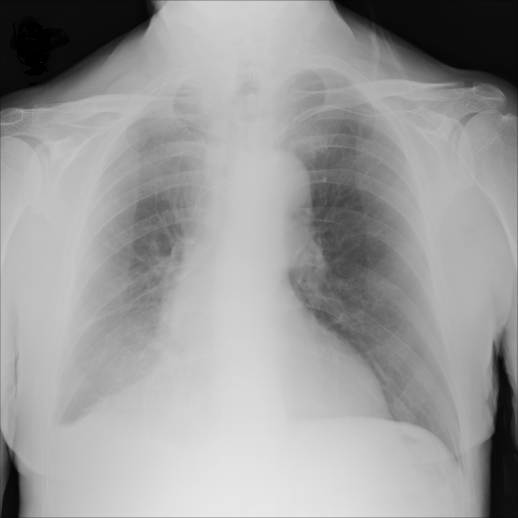 Figure 15