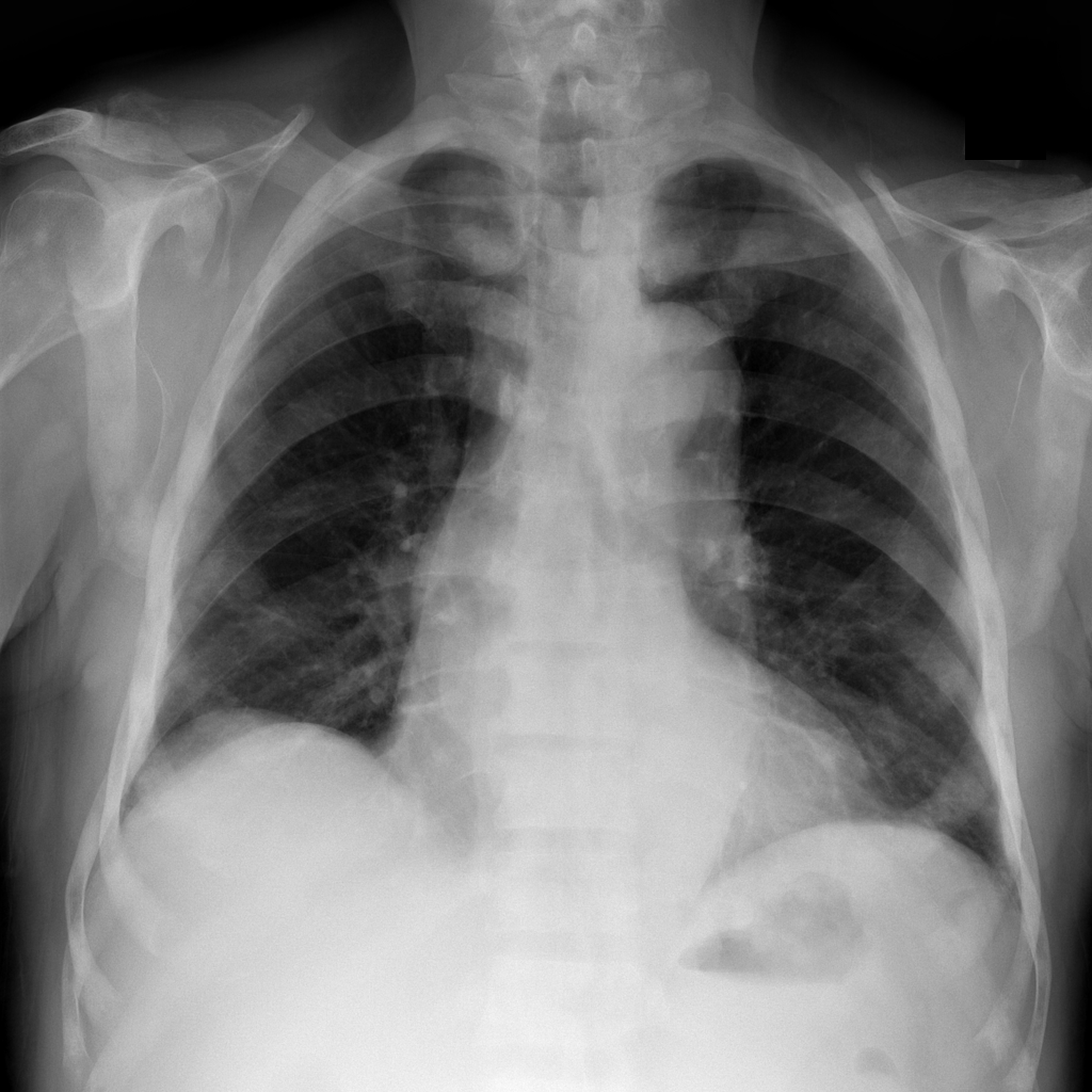 Figure 16