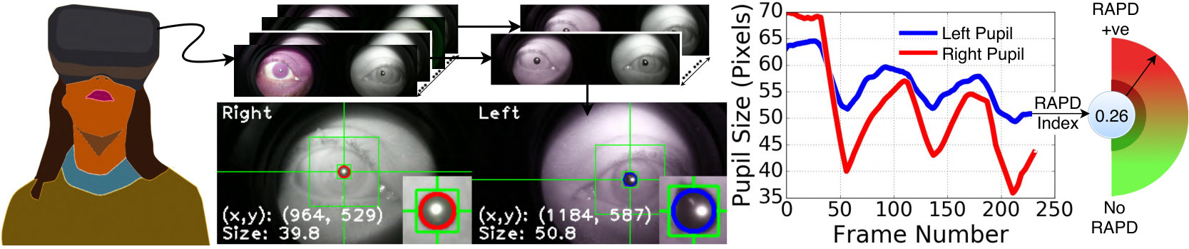 Figure 12