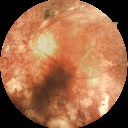 Figure 19