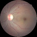 Figure 21