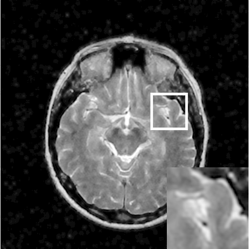 Figure 10