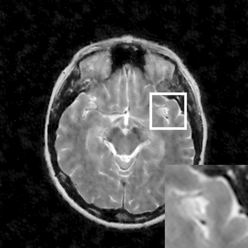 Figure 11