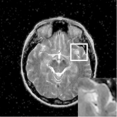 Figure 13
