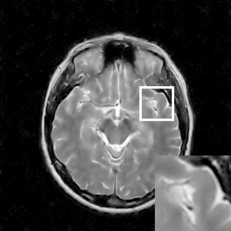 Figure 14