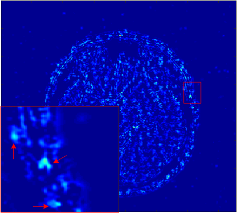 Figure 17