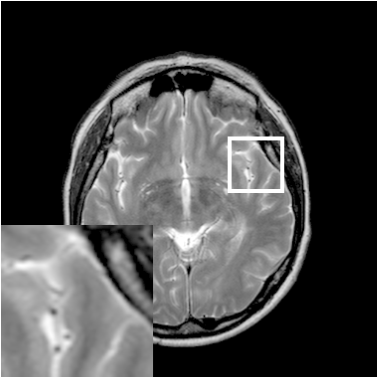 Figure 21