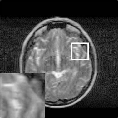 Figure 22