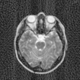 Figure 23