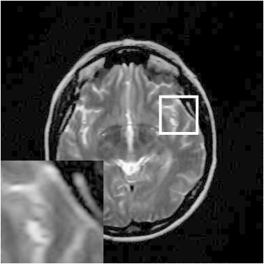 Figure 24